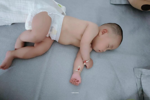 盱眙六个月宝宝眼睛散光